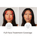 TheraFace Full Face Treatment