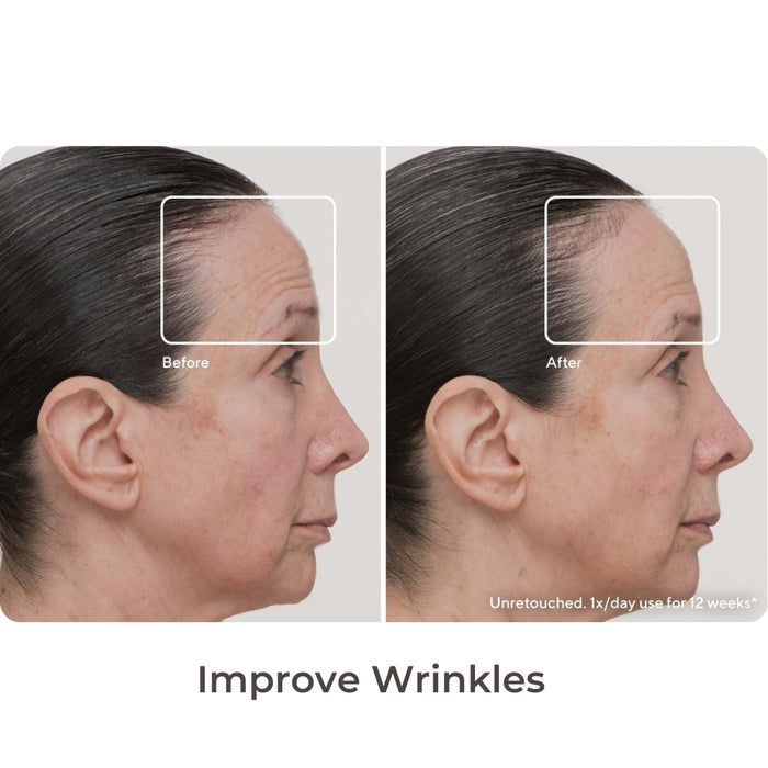 TheraFace Improved Wrinkles