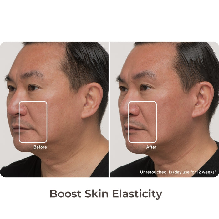 TheraFace Skin Elasticity